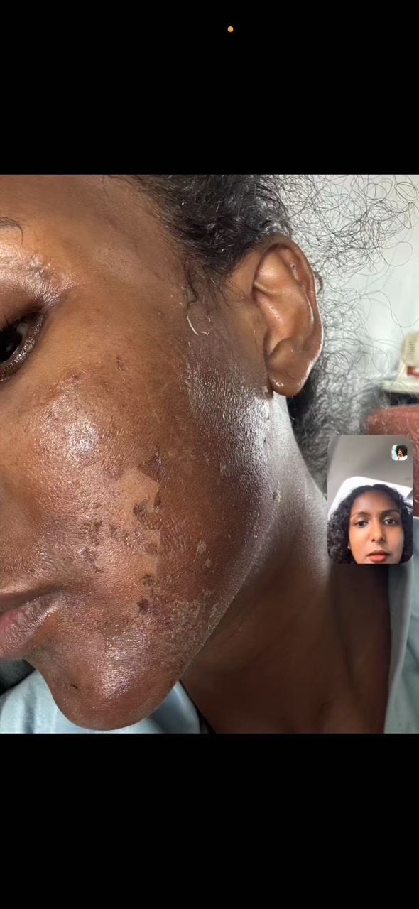 Customer photo before treatment, third angle
