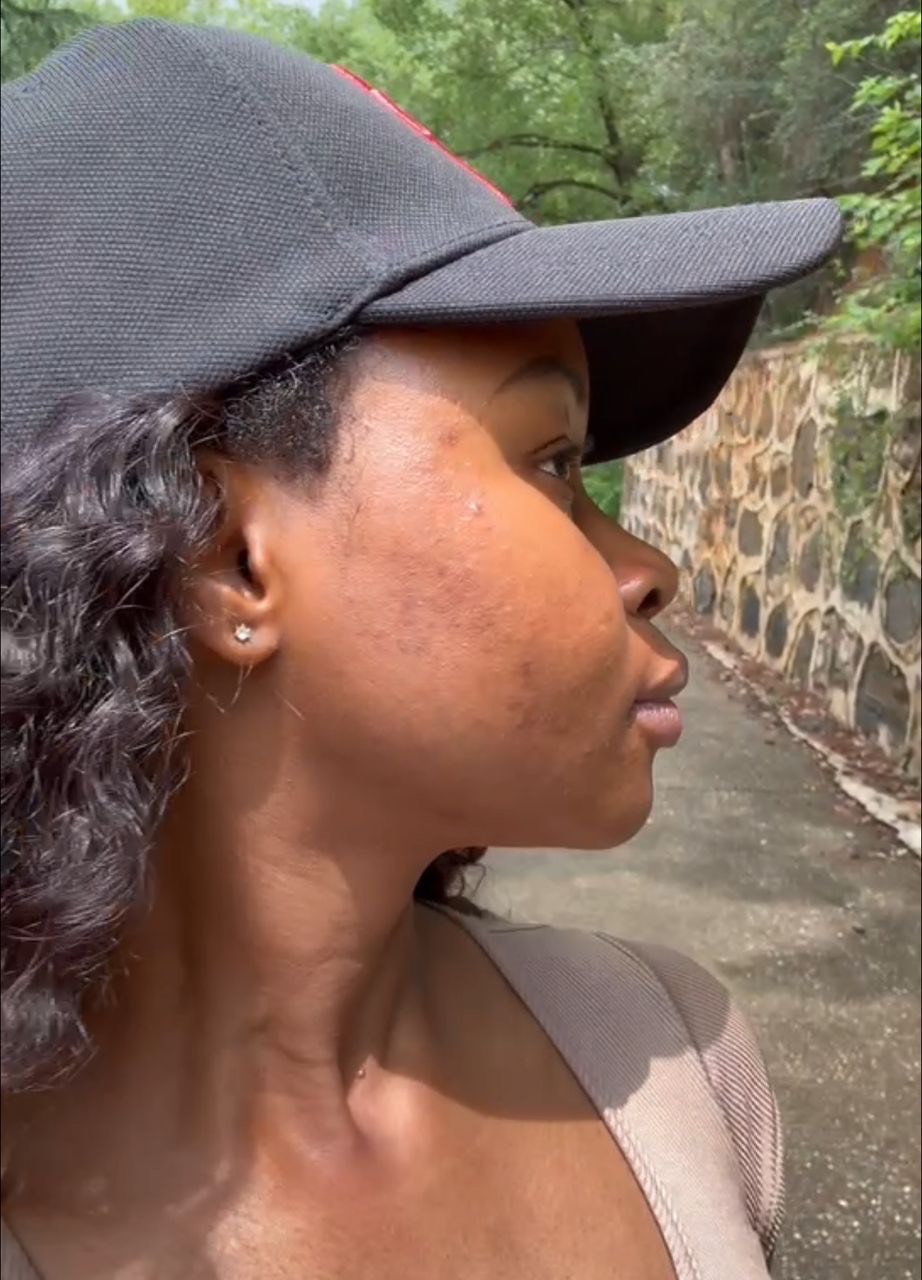 Customer photo after treatment, second angle