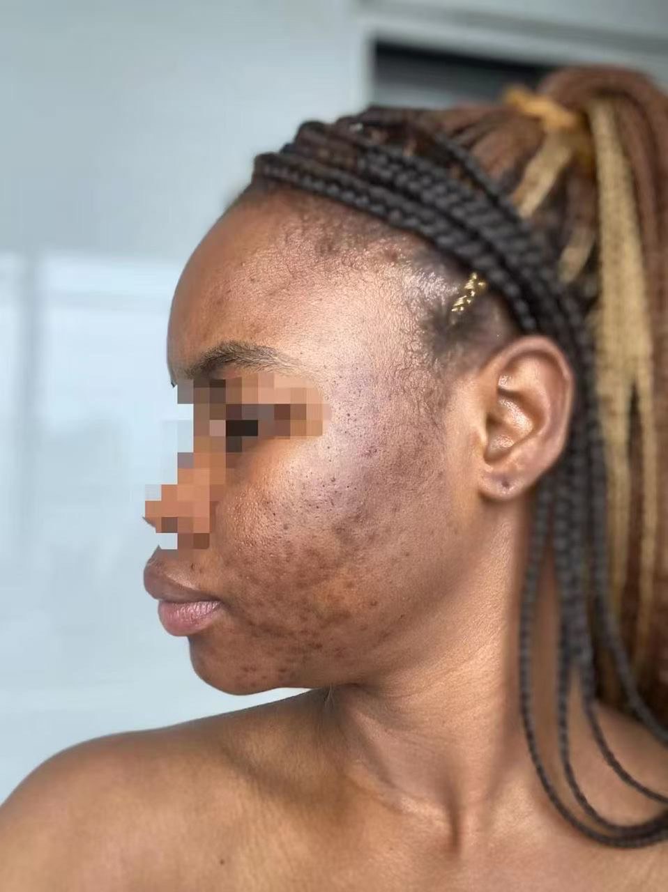 Customer photo before treatment, face blurred